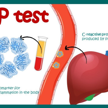 C-REACTIVE PROTEIN RAPIDcas(WB/S/P)10T/KIT